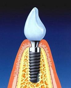 Art dentaire moderne. Dental care.